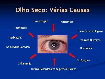 A Síndrome do Olho Seco pode comprometer aproveitamento escolar do adolescente 