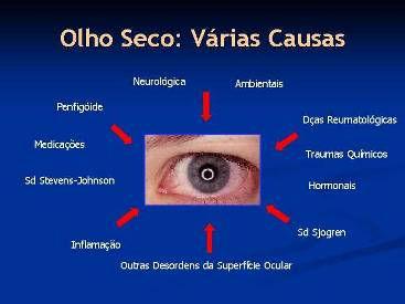 Síndrome do Olho Seco. Dr. José Álvaro Pereira Gomes